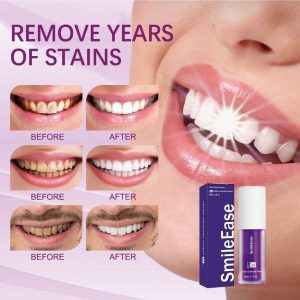 خمیر دندان های اسمایل مدلhismile v34 حجم 30 میلی لیتر