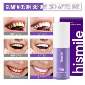 خمیر دندان های اسمایل مدلhismile v34 حجم 30 میلی لیتر